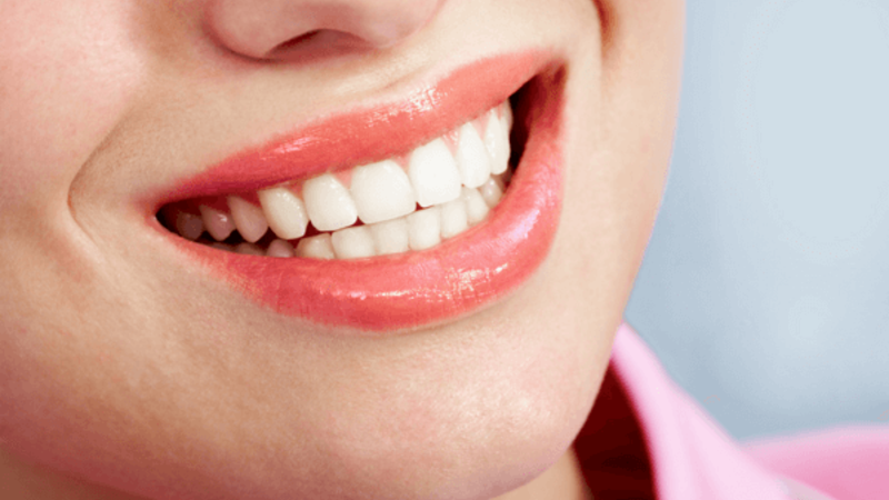 How Aesthetic Dentistry Can Boost Your Confidence