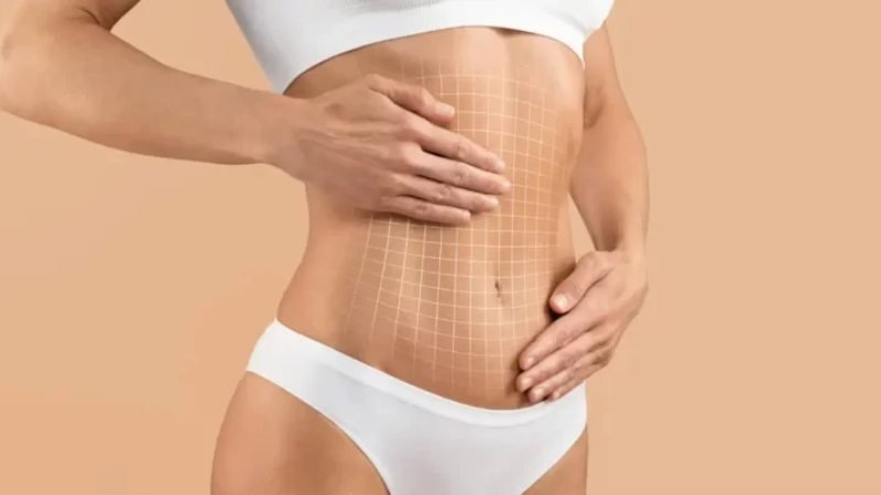 The Ultimate Guide to Liposuction Recovery: Tips and Tricks for a Smooth Journey