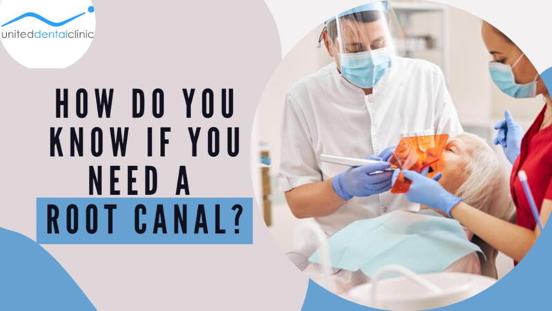 How do you know if you need a root canal?